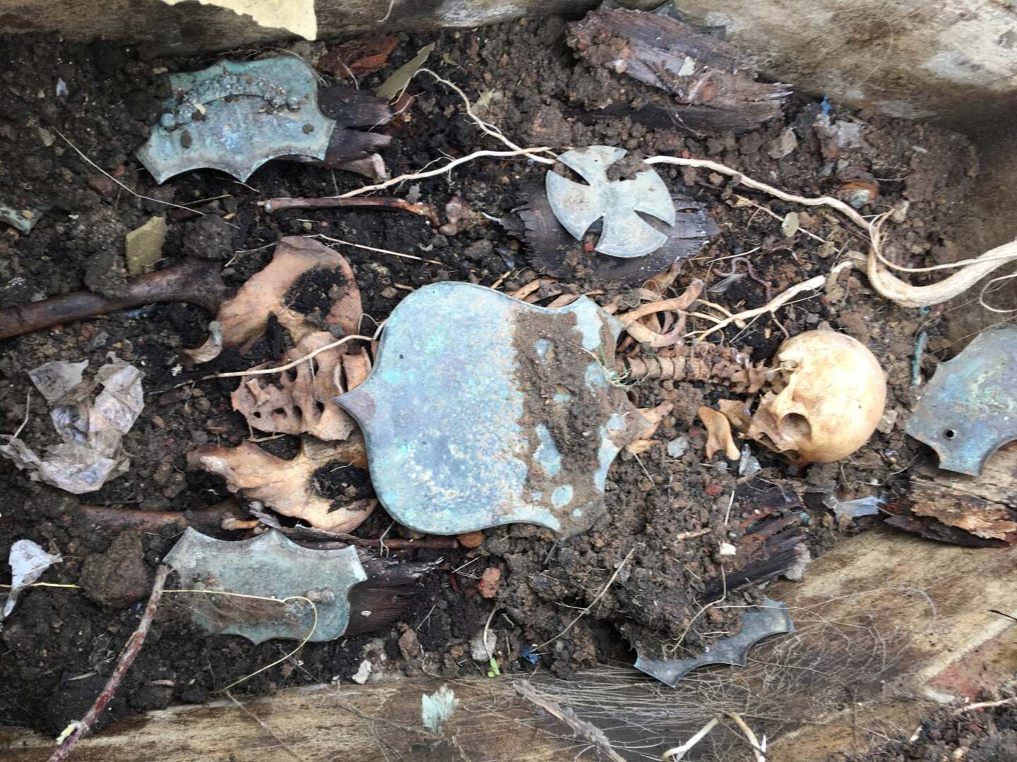 Skeletal remains